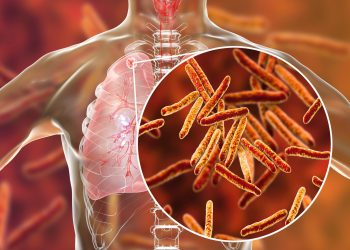 THOUSANDS of Illegal Migrant Children Released Across the US with Tuberculosis