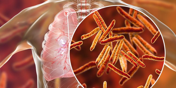 THOUSANDS of Illegal Migrant Children Released Across the US with Tuberculosis